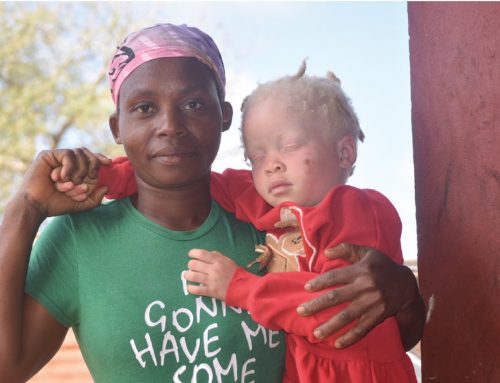 “Nasci pessoas, não animais para serem caçados”, o grito de uma mãe com três filhos albinos